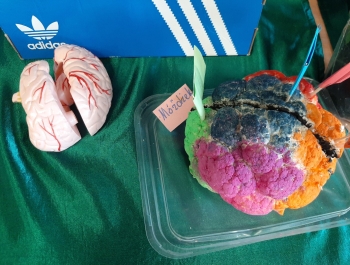 WIOSENNE TARGI ZDROWIA - zdjęcie10